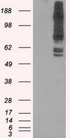 Western blot analysis of extracts from HepG2 cells, using E2F6 antibody (#TA313779).The lane on the right is treated with the synthesized peptide.