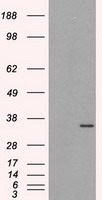 HEK293T cells were transfected with the pCMV6-ENTRY control (Left lane) or pCMV6-ENTRY LTA4H (RC207617, Right lane) cDNA for 48 hrs and lysed. Equivalent amounts of cell lysates (5 ug per lane) were separated by SDS-PAGE and immunoblotted with anti-LTA4H. Positive lysates LY424467 (100 ug) and LC424467 (20 ug) can be purchased separately from OriGene.