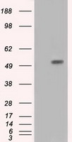 HEK293T cells were transfected with the pCMV6-ENTRY control (Left lane) or pCMV6-ENTRY SORD (RC200415, Right lane) cDNA for 48 hrs and lysed. Equivalent amounts of cell lysates (5 ug per lane) were separated by SDS-PAGE and immunoblotted with anti-SORD. Positive lysates LY401082 (100 ug) and LC401082 (20 ug) can be purchased separately from OriGene.