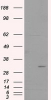 HEK293T cells were transfected with the pCMV6-ENTRY control (Cat# PS100001, Left lane) or pCMV6-ENTRY L1CAM (Cat# RC211601, Right lane) cDNA for 48 hrs and lysed. Equivalent amounts of cell lysates (5 ug per lane) were separated by SDS-PAGE and immunoblotted with anti-L1CAM (Cat# TA500728). Positive lysates [LY400150] (100 ug) and [LC400150] (20 ug) can be purchased separately from OriGene.