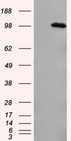 HEK293T cells were transfected with the pCMV6-ENTRY control (Left lane) or pCMV6-ENTRY HDAC10 (RC218536, Right lane) cDNA for 48 hrs and lysed. Equivalent amounts of cell lysates (5 ug per lane) were separated by SDS-PAGE and immunoblotted with anti-HDAC10. Positive lysates LY403142 (100 ug) and LC403142 (20 ug) can be purchased separately from OriGene.