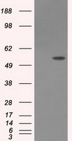 HEK293T cells were transfected with the pCMV6-ENTRY control (Left lane) or pCMV6-ENTRY AKT2 (RC217733, Right lane) cDNA for 48 hrs and lysed. Equivalent amounts of cell lysates (5 ug per lane) were separated by SDS-PAGE and immunoblotted with anti-AKT2. Positive lysates LY419836 (100 ug) and LC419836 (20 ug) can be purchased separately from OriGene.