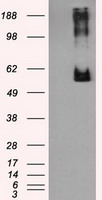 HEK293T cells were transfected with the pCMV6-ENTRY control (Left lane) or pCMV6-ENTRY RPA2 (RC205715, Right lane) cDNA for 48 hrs and lysed. Equivalent amounts of cell lysates (5 ug per lane) were separated by SDS-PAGE and immunoblotted with anti-RPA2. Positive lysates LY401031 (100 ug) and LC401031 (20 ug) can be purchased separately from OriGene.