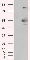 HEK293T cells were transfected with the pCMV6-ENTRY control (Left lane) or pCMV6-ENTRY GBE1 (RC204152, Right lane) cDNA for 48 hrs and lysed. Equivalent amounts of cell lysates (5 ug per lane) were separated by SDS-PAGE and immunoblotted with anti-GBE1. Positive lysates LY400056 (100 ug) and LC400056 (20 ug) can be purchased separately from OriGene.