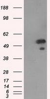 Western blot analysis of extracts from HeLa cells, COLO cells, MCF-7 cells and HepG2 cells, using RED antibody.The lane on the right is treated with the synthesized peptide.