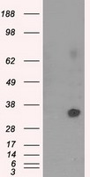 HEK293T cells were transfected with the pCMV6-ENTRY control (Left lane) or pCMV6-ENTRY RALBP1 (RC201524, Right lane) cDNA for 48 hrs and lysed. Equivalent amounts of cell lysates (5 ug per lane) were separated by SDS-PAGE and immunoblotted with anti-RALBP1. Positive lysates LY402031 (100 ug) and LC402031 (20 ug) can be purchased separately from OriGene.