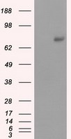 HEK293T cells were transfected with the pCMV6-ENTRY control (Left lane) or pCMV6-ENTRY SRR (RC210359, Right lane) cDNA for 48 hrs and lysed. Equivalent amounts of cell lysates (5 ug per lane) were separated by SDS-PAGE and immunoblotted with anti-SRR. Positive lysates LY402897 (100 ug) and LC402897 (20 ug) can be purchased separately from OriGene.