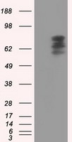 HEK293T cells were transfected with the pCMV6-ENTRY control (Left lane) or pCMV6-ENTRY SRR (RC210359, Right lane) cDNA for 48 hrs and lysed. Equivalent amounts of cell lysates (5 ug per lane) were separated by SDS-PAGE and immunoblotted with anti-SRR. Positive lysates LY402897 (100 ug) and LC402897 (20 ug) can be purchased separately from OriGene.