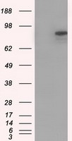 HEK293T cells were transfected with the pCMV6-ENTRY control (Left lane) or pCMV6-ENTRY SRR (RC210359, Right lane) cDNA for 48 hrs and lysed. Equivalent amounts of cell lysates (5 ug per lane) were separated by SDS-PAGE and immunoblotted with anti-SRR (TA500949). Positive lysates LY402897 (100 ug) and LC402897 (20 ug) can be purchased separately from OriGene.