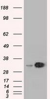 HEK293T cells were transfected with the pCMV6-ENTRY control (Left lane) or pCMV6-ENTRY SIL1 (RC211850, Right lane) cDNA for 48 hrs and lysed. Equivalent amounts of cell lysates (5 ug per lane) were separated by SDS-PAGE and immunoblotted with anti-SIL1. Positive lysates LY402924 (100 ug) and LC402924 (20 ug) can be purchased separately from OriGene.