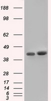 Western blot analysis of extracts from Jurkat cells and MCF-7 cells, using SEPT2 antibody.The lane on the right is treated with the synthesized peptide.