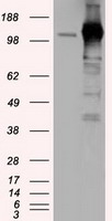 HEK293T cells were transfected with the pCMV6-ENTRY control (Left lane) or pCMV6-ENTRY NPR3 (RC219453, Right lane) cDNA for 48 hrs and lysed. Equivalent amounts of cell lysates (5 ug per lane) were separated by SDS-PAGE and immunoblotted with anti-NPR3. Positive lysates LY424462 (100 ug) and LC424462 (20 ug) can be purchased separately from OriGene.