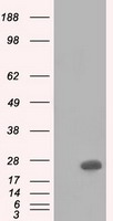 HEK293T cells were transfected with the pCMV6-ENTRY control (Left lane) or pCMV6-ENTRY SHC1 (RC204362, Right lane) cDNA for 48 hrs and lysed. Equivalent amounts of cell lysates (5 ug per lane) were separated by SDS-PAGE and immunoblotted with anti-SHC1. Positive lysates LY401060 (100 ug) and LC401060 (20 ug) can be purchased separately from OriGene.