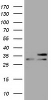 HEK293T cells were transfected with the pCMV6-ENTRY control (Left lane) or pCMV6-ENTRY NPR3 (RC219453, Right lane) cDNA for 48 hrs and lysed. Equivalent amounts of cell lysates (5 ug per lane) were separated by SDS-PAGE and immunoblotted with anti-NPR3. Positive lysates LY424462 (100 ug) and LC424462 (20 ug) can be purchased separately from OriGene.