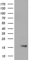 HEK293T cells were transfected with the pCMV6-ENTRY control (Left lane) or pCMV6-ENTRY NIT2 (RC210660, Right lane) cDNA for 48 hrs and lysed. Equivalent amounts of cell lysates (5 ug per lane) were separated by SDS-PAGE and immunoblotted with anti-NIT2. Positive lysates LY402761 (100 ug) and LC402761 (20 ug) can be purchased separately from OriGene.