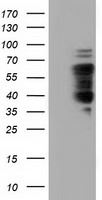 Western blot analysis of extracts from Jurkat cells, using TDG antibody.The lane on the right is treated with the synthesized peptide.