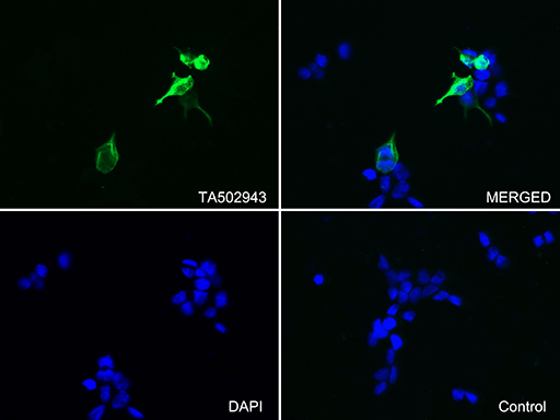 /assets/images/antibody/100/ta501778-1-f.jpg