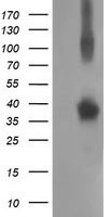 Western blot analysis of extracts from 293 cells, using SERC3 antibody.The lane on the right is treated with the synthesized peptide.
