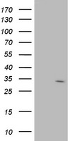 HEK293T cells were transfected with the pCMV6-ENTRY control (Left lane) or pCMV6-ENTRY PRKD2 (RC215335, Right lane) cDNA for 48 hrs and lysed. Equivalent amounts of cell lysates (5 ug per lane) were separated by SDS-PAGE and immunoblotted with anti-PRKD2. Positive lysates LY402555 (100 ug) and LC402555 (20 ug) can be purchased separately from OriGene.