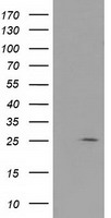 HEK293T cells were transfected with the pCMV6-ENTRY control (Left lane) or pCMV6-ENTRY GAS7 (RC215256, Right lane) cDNA for 48 hrs and lysed. Equivalent amounts of cell lysates (5 ug per lane) were separated by SDS-PAGE and immunoblotted with anti-GAS7. Positive lysates LY418527 (100 ug) and LC418527 (20 ug) can be purchased separately from OriGene.