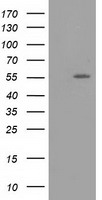 Western blot analysis of extracts of various cell lines, using NUMA1 antibody (TA315283) at 1:1000 dilution.|Secondary antibody: HRP Goat Anti-Rabbit IgG (H+L) (AS014) at 1:10000 dilution.|Lysates/proteins: 25ug per lane.|Blocking buffer: 3% nonfat dry milk in TBST.|Detection: ECL Basic Kit (RM00020).|Exposure time: 90s.