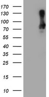 HEK293T cells were transfected with the pCMV6-ENTRY control (Left lane) or pCMV6-ENTRY EPM2AIP1 (RC209239, Right lane) cDNA for 48 hrs and lysed. Equivalent amounts of cell lysates (5 ug per lane) were separated by SDS-PAGE and immunoblotted with anti-EPM2AIP1. Positive lysates LY415014 (100 ug) and LC415014 (20 ug) can be purchased separately from OriGene.