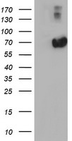 HEK293T cells were transfected with the pCMV6-ENTRY control (Left lane) or pCMV6-ENTRY OTUB2 (RC209650, Right lane) cDNA for 48 hrs and lysed. Equivalent amounts of cell lysates (5 ug per lane) were separated by SDS-PAGE and immunoblotted with anti-OTUB2. Positive lysates LY402958 (100 ug) and LC402958 (20 ug) can be purchased separately from OriGene.