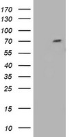 HEK293T cells were transfected with the pCMV6-ENTRY control (Left lane) or pCMV6-ENTRY TRIM2 (RC203947, Right lane) cDNA for 48 hrs and lysed. Equivalent amounts of cell lysates (5 ug per lane) were separated by SDS-PAGE and immunoblotted with anti-TRIM2. Positive lysates LY414662 (100ug) and LC414662 (20ug) can be purchased separately from OriGene.