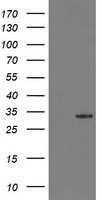 HEK293T cells were transfected with the pCMV6-ENTRY control (Left lane) or pCMV6-ENTRY MSI1 (RC215992, Right lane) cDNA for 48 hrs and lysed. Equivalent amounts of cell lysates (5 ug per lane) were separated by SDS-PAGE and immunoblotted with anti-MSI1. Positive lysates LY419331 (100 ug) and LC419331 (20 ug) can be purchased separately from OriGene.