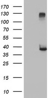 HEK293T cells were transfected with the pCMV6-ENTRY control (Left lane) or pCMV6-ENTRY DTNA (RC223952, Right lane) cDNA for 48 hrs and lysed. Equivalent amounts of cell lysates (5 ug per lane) were separated by SDS-PAGE and immunoblotted with anti-DTNA. Positive lysates LY409817 (100 ug) and LC409817 (20 ug) can be purchased separately from OriGene.