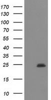 HEK293T cells were transfected with the pCMV6-ENTRY control (Left lane) or pCMV6-ENTRY DTNA (RC223952, Right lane) cDNA for 48 hrs and lysed. Equivalent amounts of cell lysates (5 ug per lane) were separated by SDS-PAGE and immunoblotted with anti-DTNA. Positive lysates LY409817 (100 ug) and LC409817 (20 ug) can be purchased separately from OriGene.