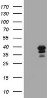 Western blot analysis of extracts (35 ug) from 9 different cell lines by using anti-PRKCE monoclonal antibody (HepG2: human; HeLa: human; SVT2: mouse; A549: human; COS7: monkey; Jurkat: human; MDCK: canine; PC12: rat; MCF7: human) (1:1000).