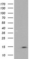 Negative control E. coli lysate (Left lane) or E. coli lysate containing recombinant protein fragment for human MCTS1 (NP_054779) gene (amino acids 1-181) (Right lane). Equivalent amounts (5 ug per lane) were separated by SDS-PAGE and then immunoblotted with anti-MCTS1.