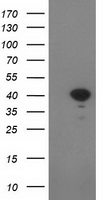 Immunohistochemistry analysis of paraffin-embedded human placenta tissue using ELOVL3 antibody.The picture on the right is treated with the synthesized peptide.