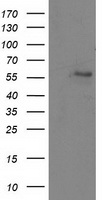 HEK293T cells were transfected with the pCMV6-ENTRY control (Left lane) or pCMV6-ENTRY EIF4E2 (RC201391, Right lane) cDNA for 48 hrs and lysed. Equivalent amounts of cell lysates (5 ug per lane) were separated by SDS-PAGE and immunoblotted with anti-EIF4E2. Positive lysates LY401518 (100 ug) and LC401518 (20 ug) can be purchased separately from OriGene.
