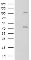 Negative control E. coli lysate (Left lane) or E. coli lysate containing recombinant protein fragment for human MCTS1 (NP_054779) gene (amino acids 1-181) (Right lane). Equivalent amounts (5 ug per lane) were separated by SDS-PAGE and then immunoblotted with anti-MCTS1.