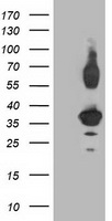 Western blot analysis of extracts from HuvEc cells, using SENP8 antibody.The lane on the right is treated with the synthesized peptide.