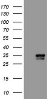 HEK293T cells were transfected with the pCMV6-ENTRY control (Left lane) or pCMV6-ENTRY SNAP25 (RC202068, Right lane) cDNA for 48 hrs and lysed. Equivalent amounts of cell lysates (5 ug per lane) were separated by SDS-PAGE and immunoblotted with anti-SNAP25. Positive lysates LY418912 (100 ug) and LC418912 (20 ug) can be purchased separately from OriGene.