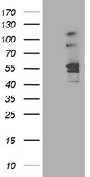 HEK293T cells were transfected with the pCMV6-ENTRY control (Left lane) or pCMV6-ENTRY EIF4E (RC207333, Right lane) cDNA for 48 hrs and lysed. Equivalent amounts of cell lysates (5 ug per lane) were separated by SDS-PAGE and immunoblotted with anti-EIF4E. Positive lysates LY400723 (100 ug) and LC400723 (20 ug) can be purchased separately from OriGene.