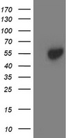 Western blot analysis of extracts from HeLa cells, using SERC2 antibody.The lane on the right is treated with the synthesized peptide.
