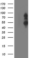 HEK293T cells were transfected with the pCMV6-ENTRY control (Left lane) or pCMV6-ENTRY PHF21B (RC204284, Right lane) cDNA for 48 hrs and lysed. Equivalent amounts of cell lysates (5 ug per lane) were separated by SDS-PAGE and immunoblotted with anti-PHF21B. Positive lysates LY408673 (100ug) and LC408673 (20ug) can be purchased separately from OriGene.