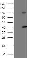 HEK293T cells were transfected with the pCMV6-ENTRY control (Left lane) or pCMV6-ENTRY MAPRE2 (RC200259, Right lane) cDNA for 48 hrs and lysed. Equivalent amounts of cell lysates (5 ug per lane) were separated by SDS-PAGE and immunoblotted with anti-MAPRE2. Positive lysates LY415395 (100 ug) and LC415395 (20 ug) can be purchased separately from OriGene.