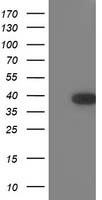 HEK293T cells were transfected with the pCMV6-ENTRY control (Left lane) or pCMV6-ENTRY SNAP25 (RC202068, Right lane) cDNA for 48 hrs and lysed. Equivalent amounts of cell lysates (5 ug per lane) were separated by SDS-PAGE and immunoblotted with anti-SNAP25. Positive lysates LY418912 (100 ug) and LC418912 (20 ug) can be purchased separately from OriGene.