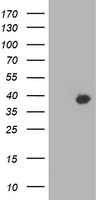Western blot analysis of extracts from HeLa cells, using ATF2 (Ab-71 or 53) Antibody.The lane on the right is treated with the synthesized peptide.