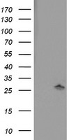 Anti-ENPP3 antibody IHC of human uterus. Immunohistochemistry of formalin-fixed, paraffin-embedded tissue after heat-induced antigen retrieval.