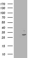 Anti-ERP44 / TXNDC4 antibody IHC of human, placenta. Immunohistochemistry of formalin-fixed, paraffin-embedded tissue after heat-induced antigen retrieval.