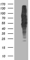 Anti-GPR61 antibody IHC of human brain, caudate. Immunohistochemistry of formalin-fixed, paraffin-embedded tissue after heat-induced antigen retrieval.