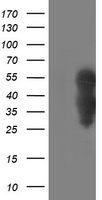 Anti-GPR88 antibody IHC of human brain, caudate. Immunohistochemistry of formalin-fixed, paraffin-embedded tissue after heat-induced antigen retrieval.