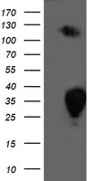Anti-GRPR antibody IHC of human colon. Immunohistochemistry of formalin-fixed, paraffin-embedded tissue after heat-induced antigen retrieval.