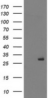 Anti-FKSG80 / GPR81 antibody IHC of human Ovary, Carcinoma. Immunohistochemistry of formalin-fixed, paraffin-embedded tissue after heat-induced antigen retrieval.
